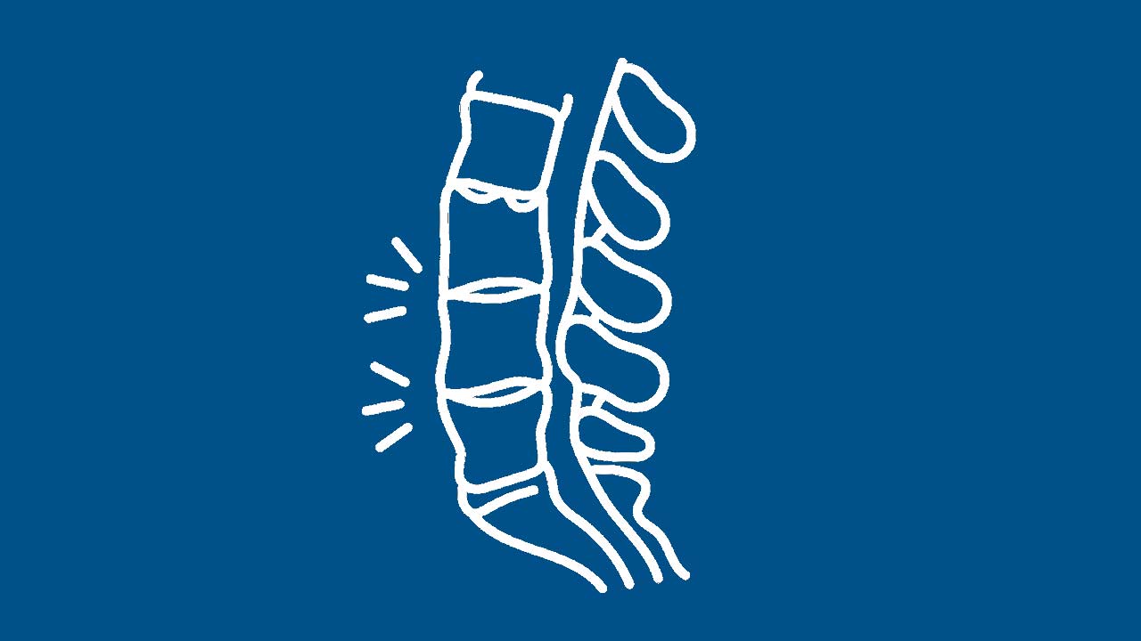 Spine Surgery