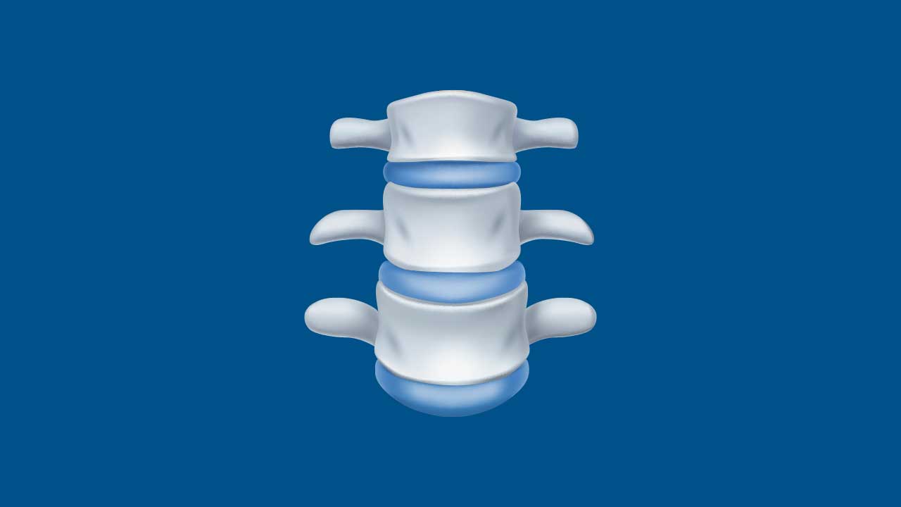 spine-202507.jpg